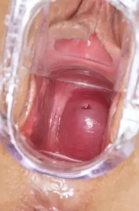 Images 12 - Оргазм во время гинекологического осмотра 