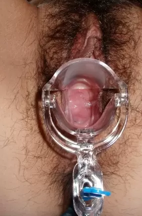 Images 15 - Показала вагину через расширитель (15 фото) 