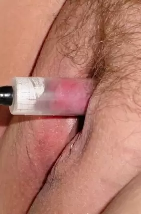 Images 1 - Сочные вагины после вакуумной помпы 
